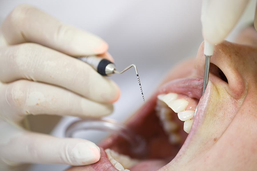 Advanced Care for Healthy Gums: Periodontics in Bluff City, TN