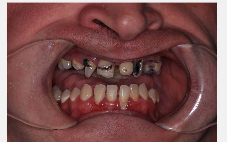 Center for Family and Implant Dentistry