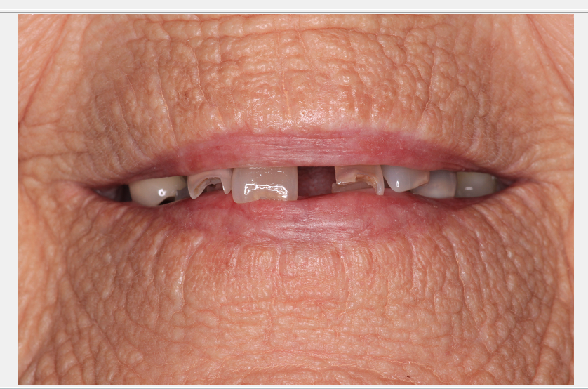 Center for Family and Implant Dentistry