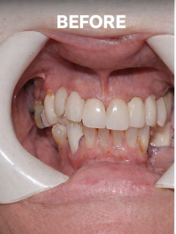 Center for Family and Implant Dentistry